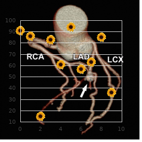 Overgrowth radial ray defect arthrogryposis