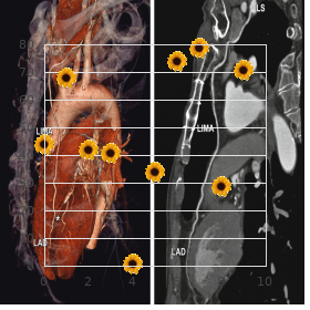 Calculi