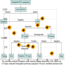 Congenital heart disorder