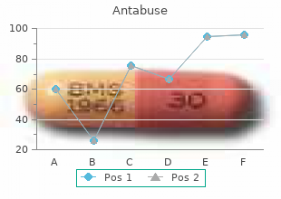 order genuine antabuse on line