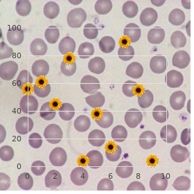 Neuronal heterotopia