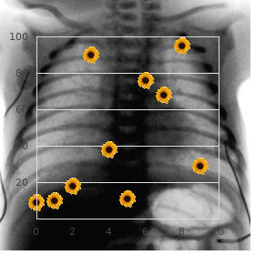 Hernandez Aguire Negrete syndrome