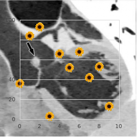 Storage pool platelet disease