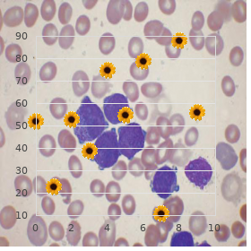 Lipodystrophy Rieger anomaly diabetes