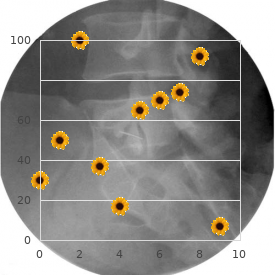 Lacrimo-auriculo-dento-digital syndrome