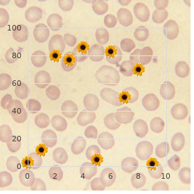 Bustos Simosa Pinto Cisternas syndrome