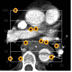 Caratolo Cilio Pessagno syndrome