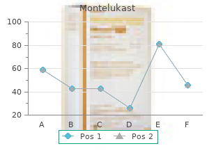 cheap montelukast 4mg fast delivery