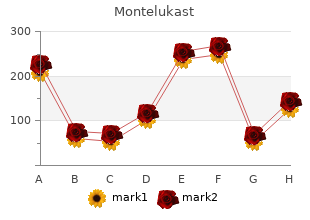 montelukast 4mg amex