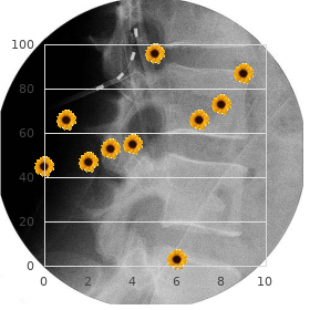 Focal dermal hypoplasia