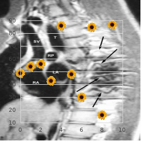 Lymphocytic infiltrate of Jessner