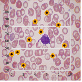 Spongy degeneration of central nervous system