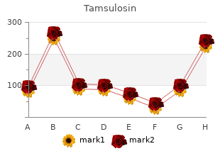 cheap tamsulosin 0.4mg fast delivery