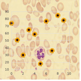 Chromosome 16, trisomy 16q