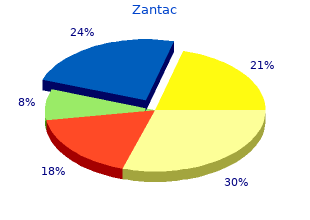 generic 150 mg zantac free shipping