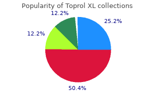 generic toprol xl 50mg on line