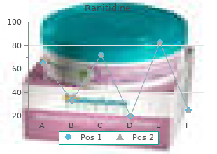 purchase ranitidine 300 mg