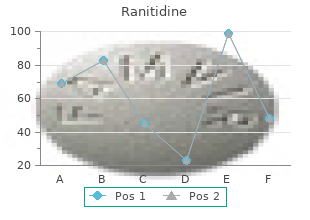 buy ranitidine online now