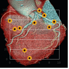 Hydrocephalus craniosynostosis bifid nose