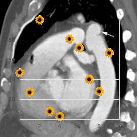 Congenital adrenal hyperplasia, lipoid