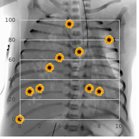 De Hauwere Leroy Adriaenssens syndrome