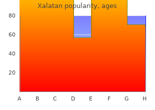 order 2.5  ml xalatan fast delivery