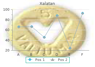 quality 2.5 ml xalatan