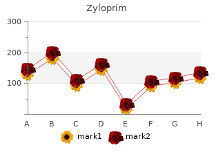generic 300 mg zyloprim with visa